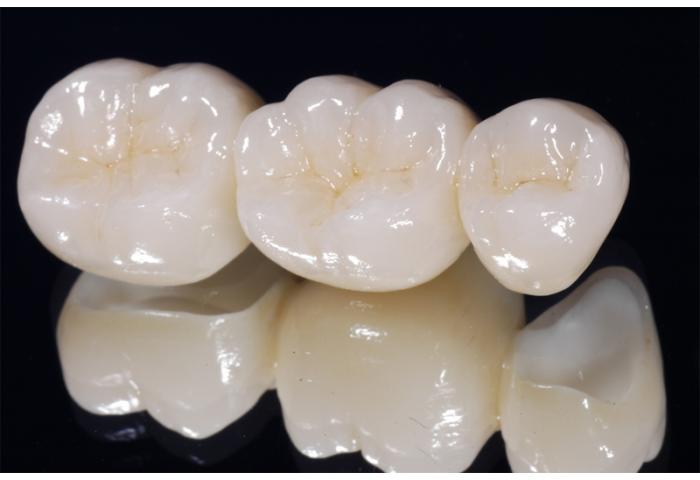 протезирование зубов в москве