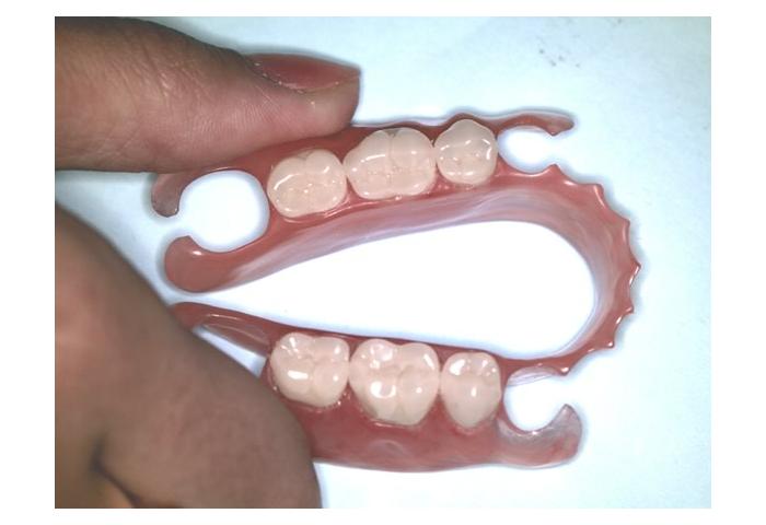 зубное протезирование в москве