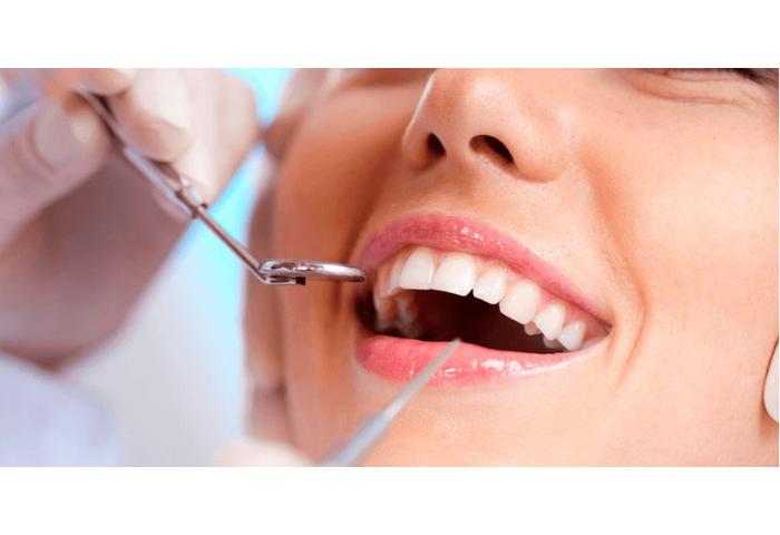 как ухаживать за зубными имплантами