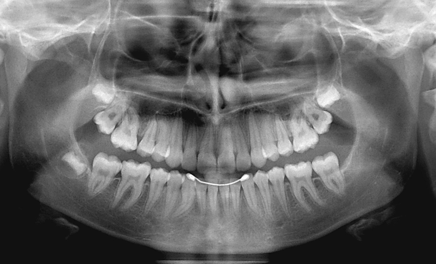 Снимок зуба Томск Залесская 10 поликлиника стоматология телефон томск
